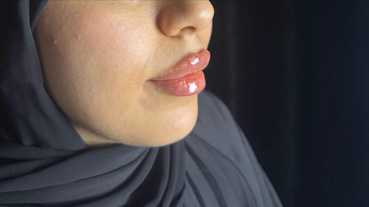خلي ابتسامتج تحچي عنج… وشفايفج تكمل جمالج. 💋
* لأن الجمال الحقيقي هو التناسق، مو المبالغة
الدكتورة ساره عدنان
