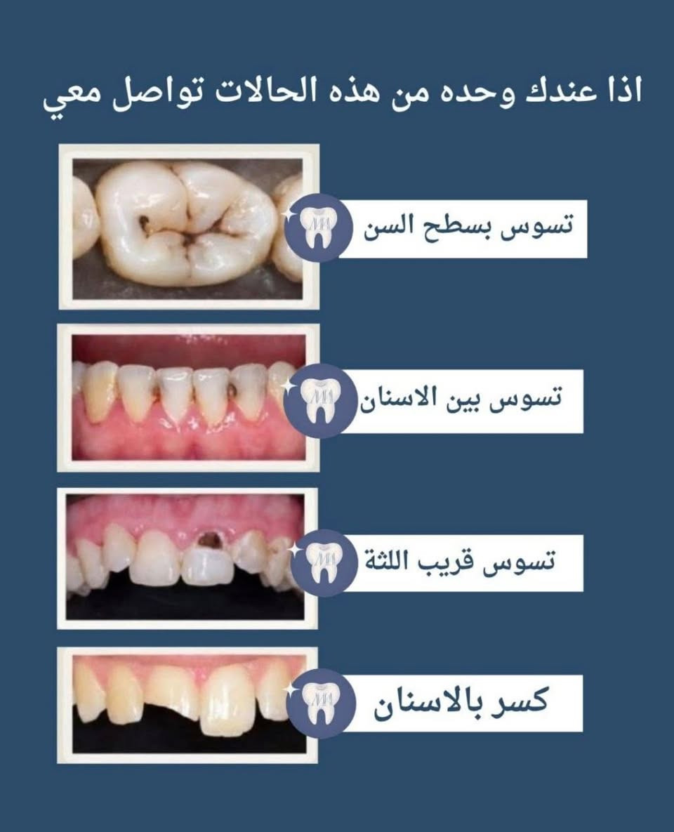 اي حاله عندكم او عند أقاربكم تكدرون تتواصلون خاص للمعالجه + حالات قلع الأسنان والجذور المتبقيه الحجز للأسبقية والعلاج مجاني عدا التعويضات ب اسعار بسيطه

نص مكتوب في الصور:
- احد من اهلكم عنده هيج فقد بأسنانه؟ او شي مشابه لهاي الحاله
- او هيج فقد يكون قبله سن وبعده سن من الجهتين
- او هيج فقد يكون سن واحد او سنين من الاسنان الاماميه
- اذا عندك وحده من هذه الحالات تواصل معي تسوس بسطح السن تسوس بين الاسنان تسوس قريب اللثة كسر بالاسنان