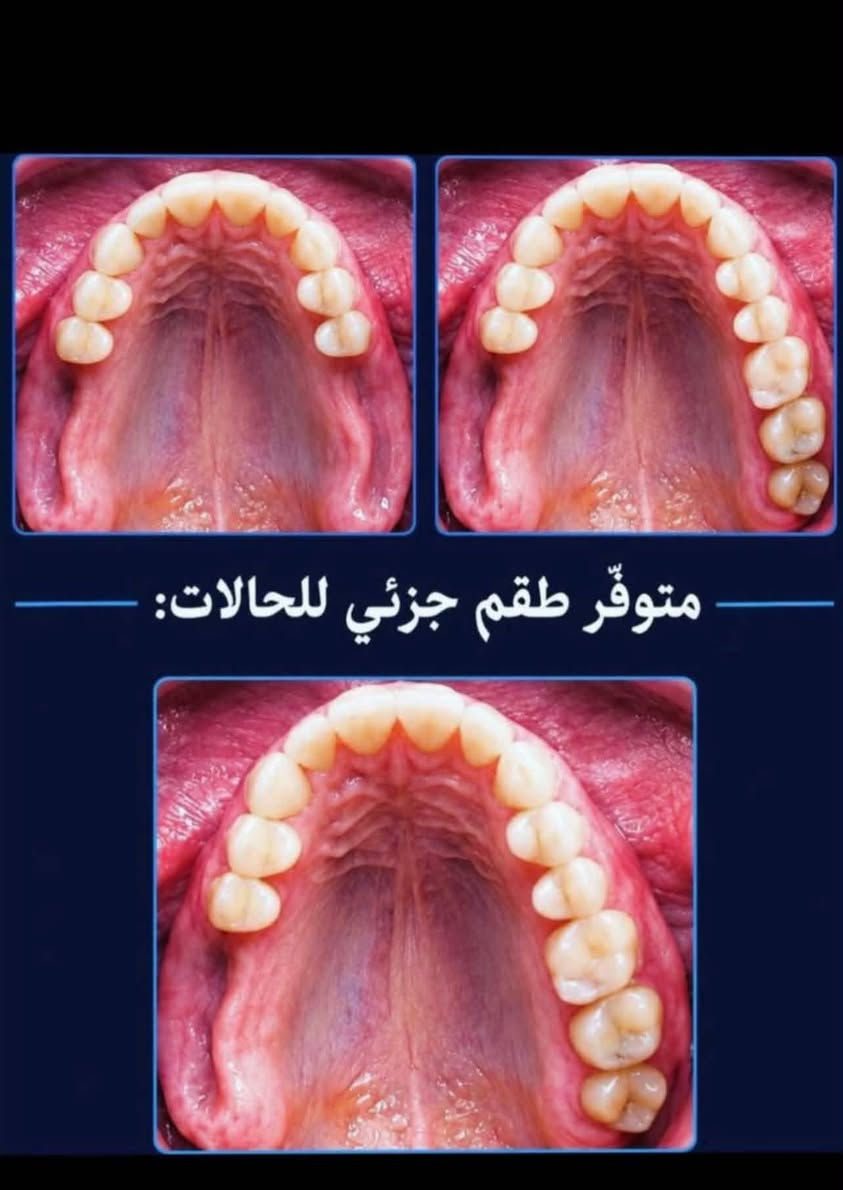 الجامعة الوطنية • علاج مجاني • تنظيف أسنان