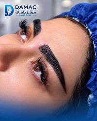 زراعة حاجب • بيبي هير • المنصور الداوودي