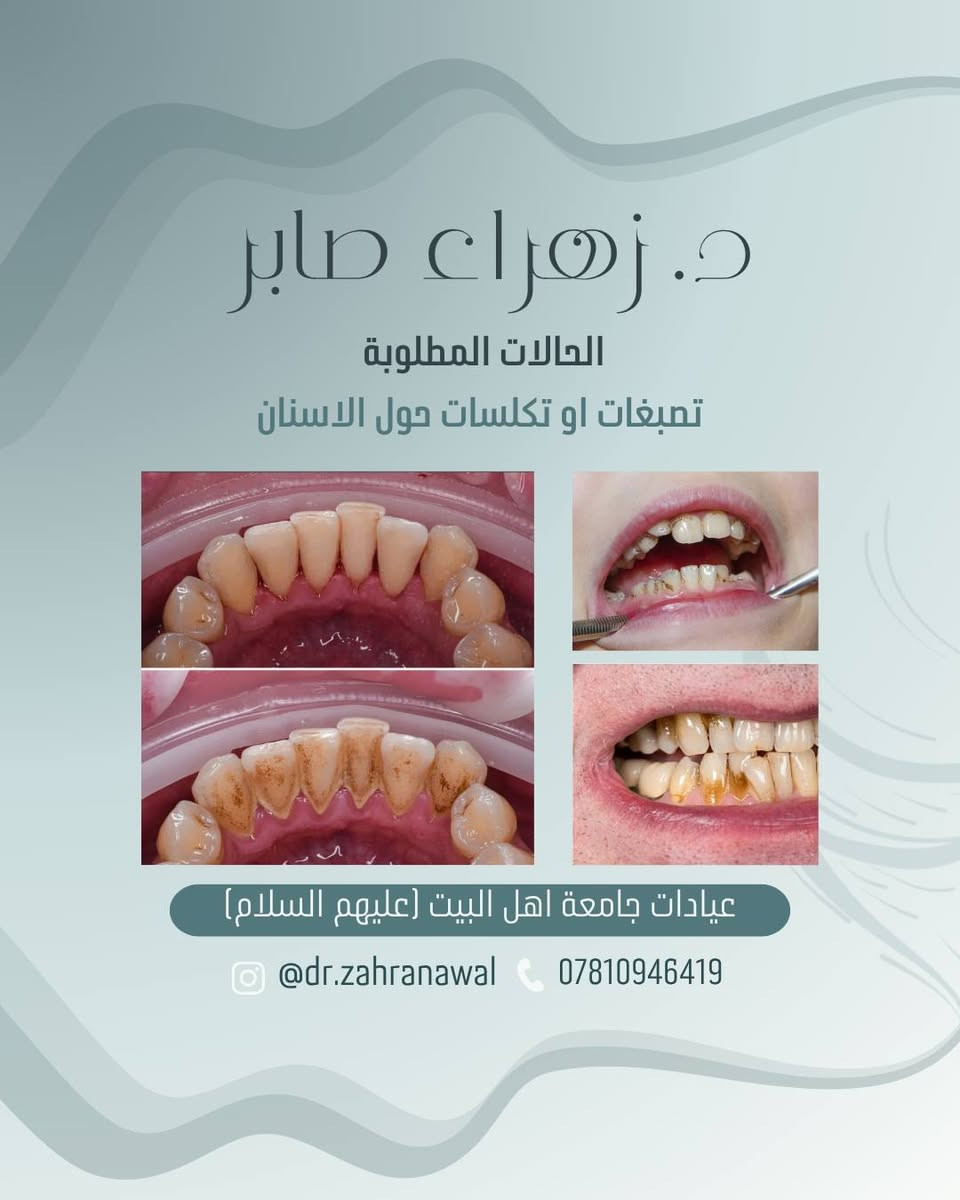 العلاج مجاناً 🤍
إذا كانت حالتكم مطابقة للحالات المطلوبة أو لديكم استفسار، يمكنكم التواصل معي عبر الخاص أو الانستغرام أو رقم الهاتف الموجود في الكارت.

أهلاً وسهلاً بكم، ونسعد بخدمتكم.

نص مكتوب في الصور:
- د. زهراء صابر
- فحص الفم والاسنان
- قلع الاسنان والجذور المتبقية
- تنظيف الاسنان وازالة التكلست
- عمل الحشوات الضوئية (تجميلية)
- تعويض الاسنان المفقودة بطقم جزئي
- عيادات جامعة اهل البيت (عليهم السلام)
- @dr.zahranawal
- ***********
- علماً العلاج مجاناً
- الحالات المطلوبة
- تمبغات او تكلسات حول الاسنان
- @dr.zahranawal ***********
- د. زهراء صابر الحالات المطلوبة تسوس في الاسنان الخلفية عيادات جامعة اهل البيت (عليهم السلام) @dr.zahranawal ***********
- تسوس او كسر في الاسنان الأمامية
- د. زهراء صابر الحالات المطلوبة بقايا الجذور والاسنان التالفة والقلع لغرض التقويم عيادات جامعة اهل البيت (عليهم السلام) @dr.zahranawal ***********