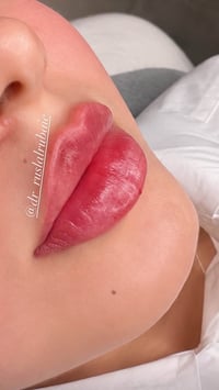 فلر • عروض • نيوفيا