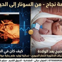 رعاية حوامل • تشخيص 4D • المقدادية ديالى