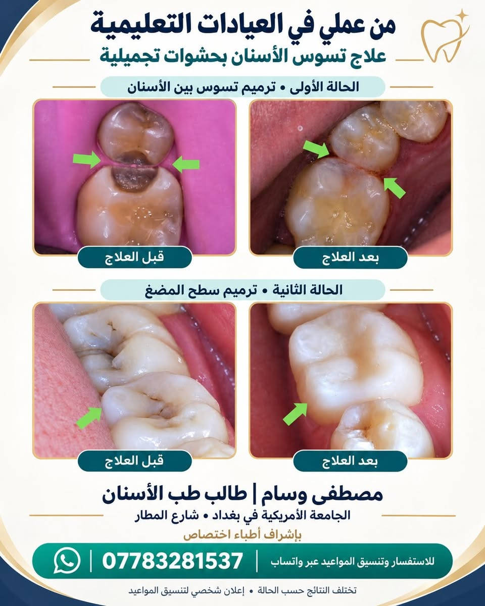 مجاناً • الجامعة الأمريكية • علاجات أسنان
