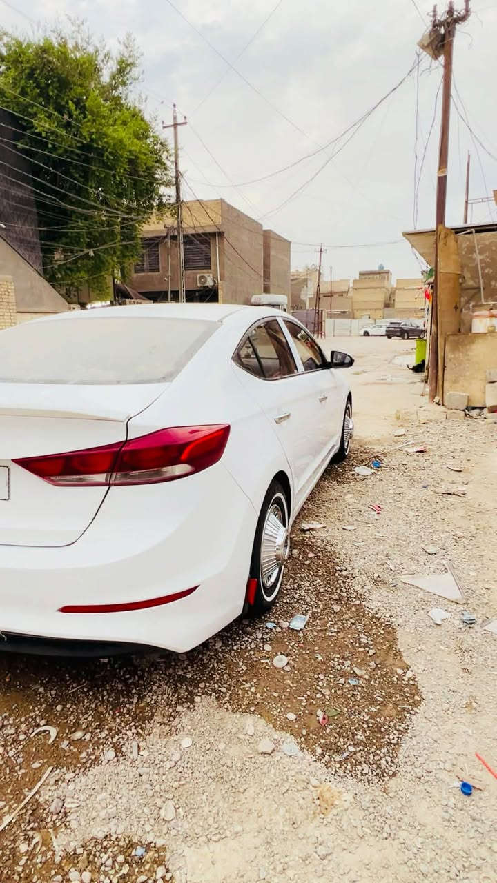 النترا • موديل 18 • كفالة عامة