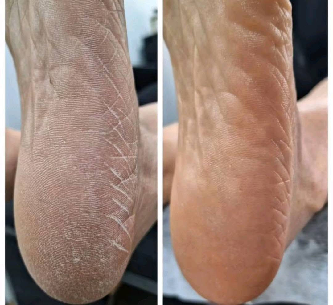 لأوووول مرة هالعرررض الناررري💣❤‍🔥❤‍🔥❤‍🔥 يم صالون شمس سويتلكم عررض (اكرلك مع دزاين+تنضيف قدم بالماسكات) كل هذا بسعر 35 الف فقطط😍😍❤‍🔥 ماكو هيج دلال اتنورونه ❤
 صالون شمس بغداد الغدير شارع لحوم نور الهدى بجانب مكوى الامير (***********)
@إشارة
