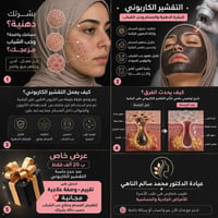 تقشير كاربوني • حب الشباب • حي الانتصار