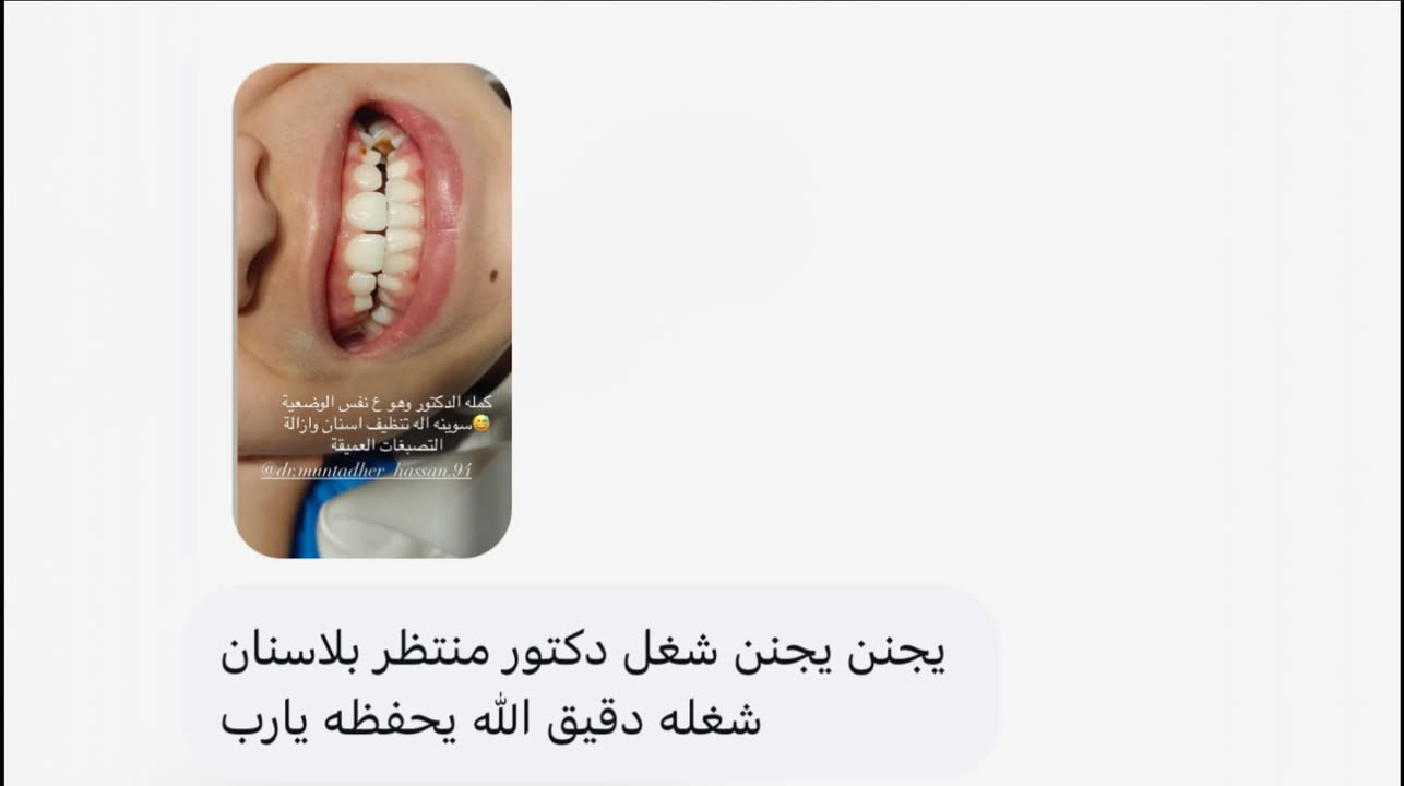 من حالات طب الاسنان بعيادتنا 🤍🦷✅ تنظيف الاسنان لطفل بسبب اهمال التفريش وحالة تبييض اسنان بالليزر بجلسة واحدة

عيادة الدكتورة مروة محمد التميمي

🏥الديوانية العروبة-شارع المتحف-مجاور مطعم كودو كودو
📞رقم الحجز ***********

متوفر نظام التقسيط على الماستر كارد
