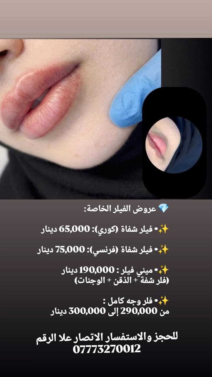 تجميل غير جراحي • فيلر شفاه • الزعفرانية