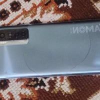 موبايل تكنو كامون 17برو للبيع ب90الف قفل كلشي مابدل بس الضهر مكسور الر...