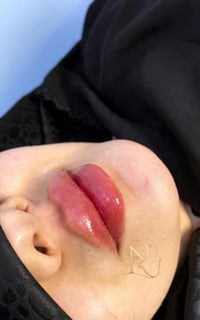 فلر شفة • ١سيسي • الناصرية