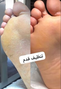 تنضيف قدم واي جلش10