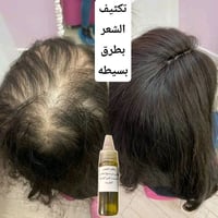 زيت تكثيف • طبيعي ١٠٠٪ • ٥٠مل ١٠٠مل