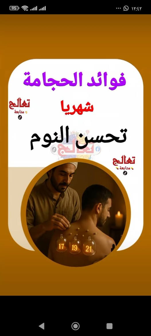 حجامة شهرية • تحسين النوم • تخفيف صداع