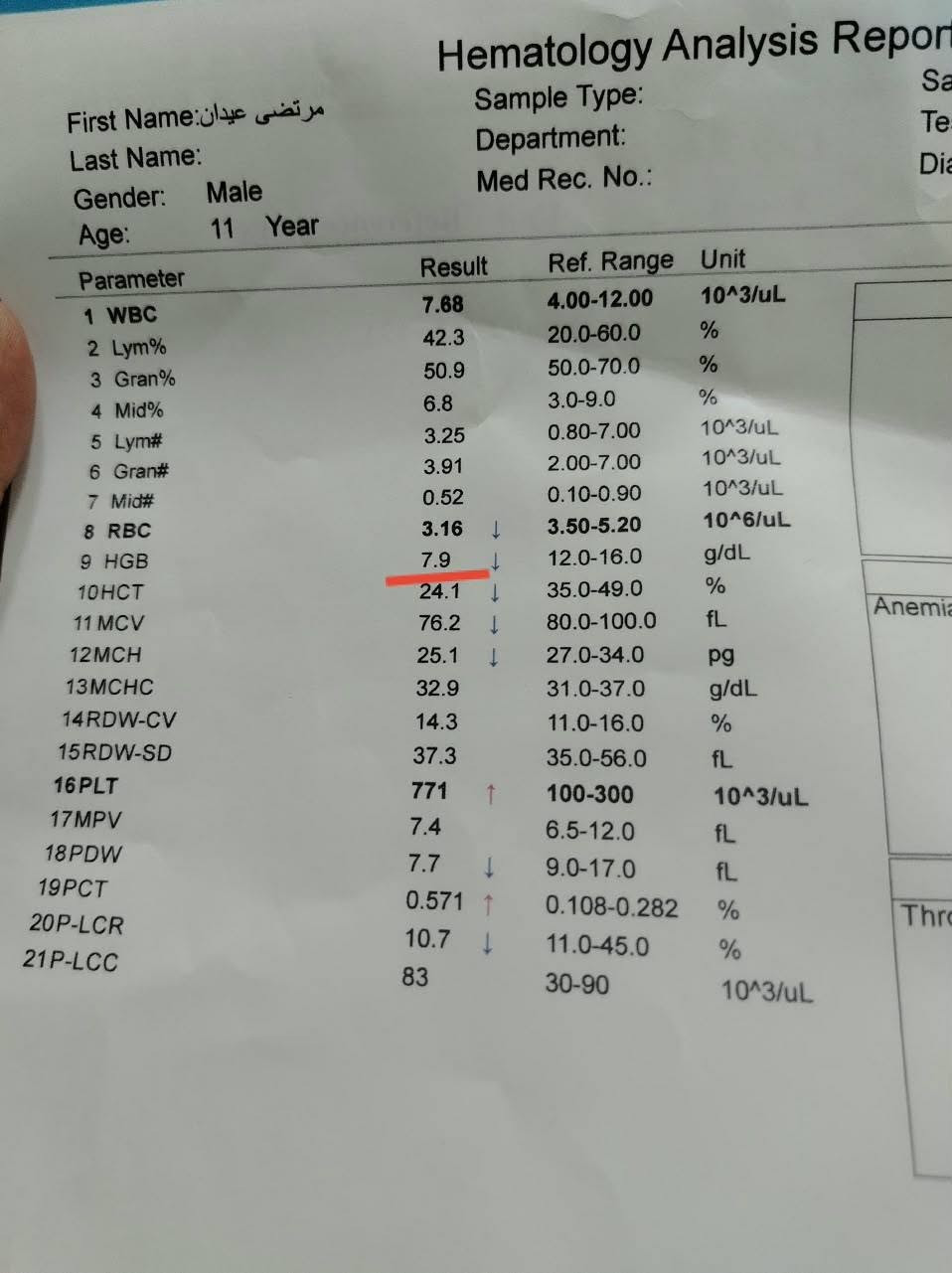 طفل عمره 11 سنة، استمرت عنده الحمى أكثر من 12 يوم، وياها تشقق بالشفايف، تقشر بالأطراف، طفح جلدي وتضخم بعقدة لمفاوية بالرقبة.
بالفحوصات: CRP: 187 | ESR: 55  ____ 771/ Platelets 
وبعد الفحص السريري وإجراء إيكو للقلب، صار عدنا اشتباه قوي بمرض كاواساكي.
تم البدء بالعلاج المناسب والمتابعة الدقيقة، والحمد لله كانت الاستجابة ممتازة؛
#عيادة #الدكتورة #شفق #قاسم #مجيد #الميالي 
اختصاص البورد العراقي في طب الأطفال وحديثي الولاده
الحمزة الشرقي شارع الأطباء مجمع اوزون الطبي O3 
 رقم الحجز ***********
