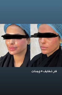 إطلالة جديدة وتغيير شامل ينتظركِ مع الدكتورة هبة! ✨ أطلقنا لكِ أحدث عر...