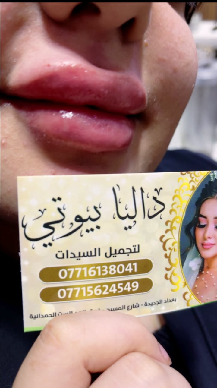 🔥🔥 أقوى عروض داليا بيوتي 🔥🔥
⏰ العرض لمدة 3 أيام فقط ⏰
💥💥 سوي شغلتين والثالثة عليناااا مجاناً 🎁
يعني تدفعين قيمة شغلتين فقط، والثالثة هدية من داليا بيوتي 😍
💇🏻‍♀️ عروض الشعر:
✨ صبغ ميش للشعر القصير — 15 ألف فقط مع هديه قص 
✨ صبغ ميش للشعر الوسط للكتف — 20 ألف فقط مع هديه تريتمنت 
✨ الشعر الطويل والثخين — يحدد بعد المعاينة وعليه خصم حلو 🔥
✨ صبغ + بروتين للشعر التعبان والمتقصف — 20 ألف فقط
✨ ميش + بروتين للشعر التعبان والمتقصف — 20 ألف فقط
✨ سلفون جميع أطوال الشعر — 25 ألف فقط
✨ شسوار جميع أطوال الشعر — 10 آلاف فقط

✨ تسريح الشعر القصير الكاريه — 20 ألف فقط مع هديه معالج 
✨ تسريح الشعر الوسط للكتف — 30 ألف فقط مع هديه معالج 
✨ تسريح الشعر الطويل والأفريقي — يحدد داخل السنتر وعليه خصم وعرض كلش حلو 👑
👁️ الرموش:
✨ رموش طرفية — 5 آلاف فقط
✨ رموش كاملة — 10 آلاف فقط
❤️❤️
💅🏻 الأظافر:
✨ أكرلك إيد + جلش — 15 ألف فقط
✨ أكرلك قدم + جلش — 10 آلاف فقط
✨ جلش — 5 آلاف فقط
✨ دزاين — 5 آلاف فقط
✨ تنظيف إيد — 5 آلاف فقط
💆🏻‍♀️ العناية والجمال:
✨ حف — 5 آلاف فقط
✨ تنظيف بشرة — 5 آلاف فقط
✨ تنظيف قدم — 5 آلاف فقط
✨ هايدرو فيشل — 5 آلاف فقط
✨ قص عادي — 5 آلاف فقط
✨ شسوار شعر ولادي — 5 آلاف فقط
✨ ثقب أذان — 5 آلاف فقط
✨ شامة تاتو — 5 آلاف فقط
✨ وشمة حرف صغير — 5 آلاف فقط
🎁🔥 وتذكريييي:
تسوين شغلتين وتدفعين حساب شغلتين فقط
والشغلة الثالثة هدية مجاناً 🎁😍
🚨 العرض لمدة 3 أيام فقط!
لا تفوتين الفرصة واحجزي موعدچ من هسه 💗
📍 داليا بيوتي
💖 الجمال والدلال… بأسعار ما تتكرر!
العنوان /
الفرع الاول بغداد الجديده شارع المسبح تقاطع النعيريه فوق زنود الست الحمدانيه مقابيل اسواق زيتونه 

الفرع الثاني: بغداد الجديده شارع العام مجاور سنتر حي اور مقابيل باب الخروج لسنتر حي اور 
☎️***********
***********
