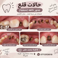 للاستفساروالتواصل ع الواتساب 07712928018  نص مكتوب في الصور: - حالات ق...