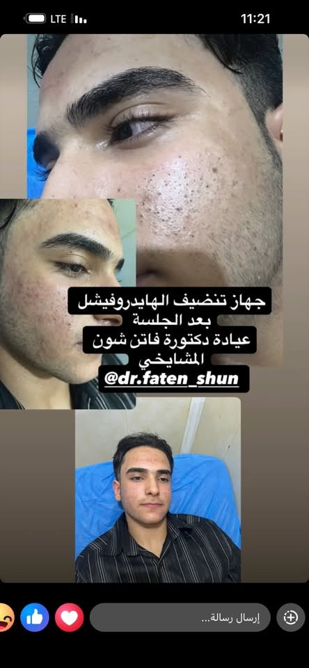 تتواجد يومياً الدكتوره فاتن شون المشايخي
اختصاص جلديه تجميليه والليزر وتساقط الشعر 
رقم الحجز ***********
