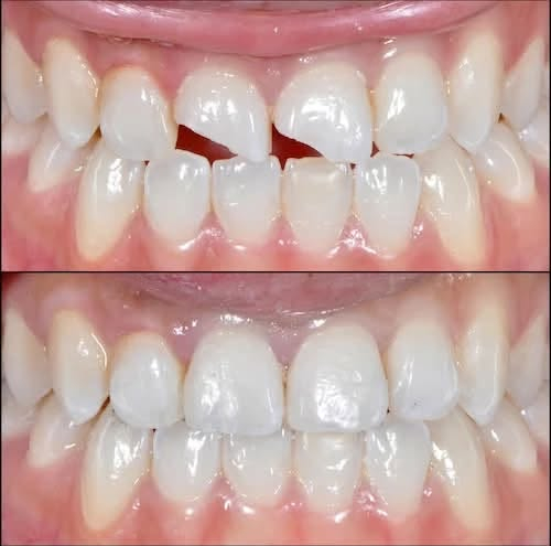 عيادة طب الأسنان لعلاج جميع حالات الأسنان (مجانا)
اللي ماعنده امكانية استفاد من علاج اسنانك مجانا
( قلع الاسنان التالفة والجذور، تنظيف الاسنان من التكيسات، تعويض الاسنان المفقودة، علاج اسنان الاطفال، تقويم الاسنان، حشوات الجذور والحشوات التجميلية
العنوان كرادة شارع 52 للتواصل خاص او على الرقم ***********
