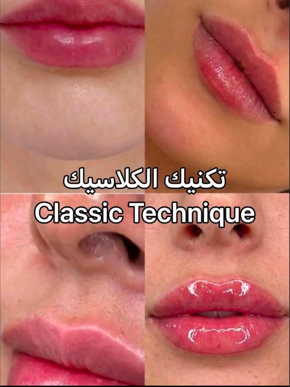 عيادة الدكتور مصطفى خميس الجنابي
اخصائي الأمراض الجلدية والحساسية والتناسلية والتجميل والليزر 
الفلر -البوتوكس-ميزوثيرابي -خيوط ذهبية -ازالة الشعر بالليزر 

العنوان/الانبار -الفلوجة -شارع الاستخبارات -مجمع البلسم الطبي- مقابل البوابة الثالثة لمستشفى الفلوجة العام

للحجز/ 
***********.
***********

