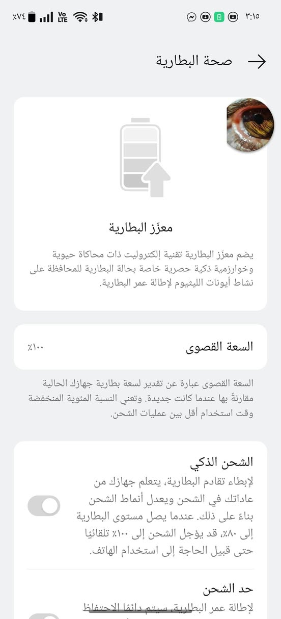 السلام عليكم 
OnePlus 13r 
لون ابيض ⚪
ذاكرة 256
بطارية 100 🔋 
معالج snp8gen3
سعة البطارية6415
مكاني بغداد الزعفرانية 
***********
السعر 550 وبي مجال
