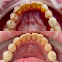 تنضيف سنان • أقساط مريحة • موظفي الرافدين