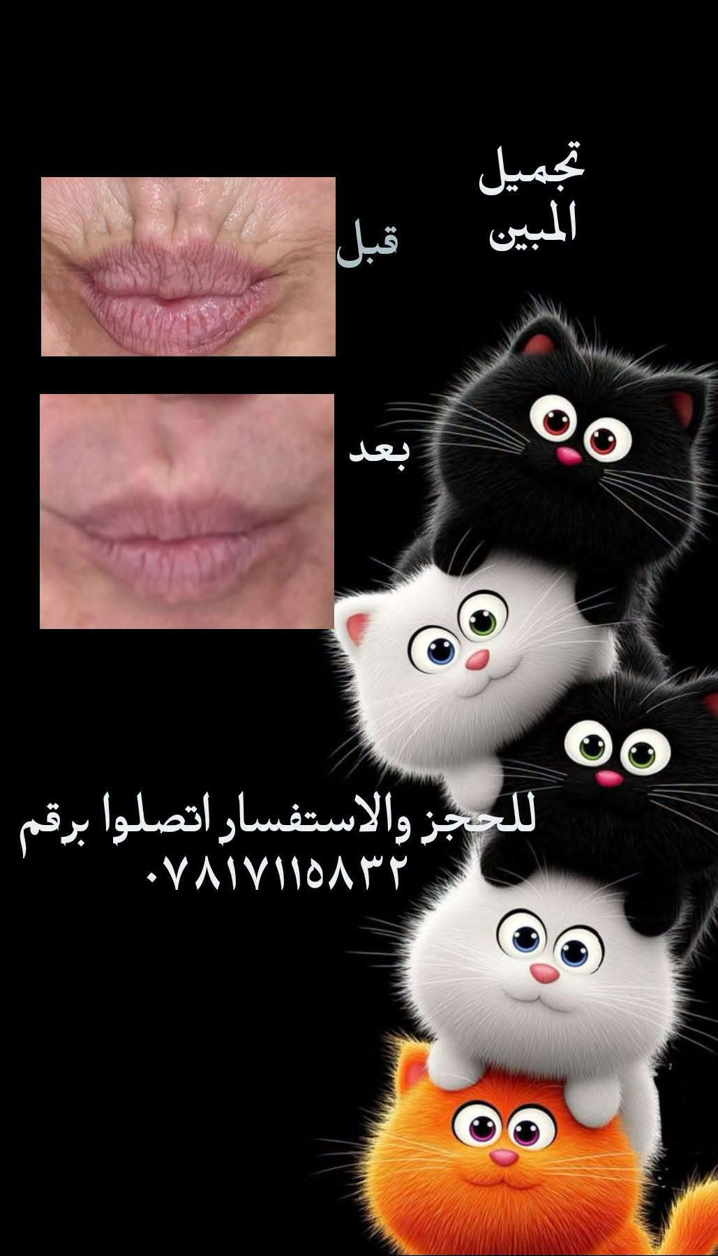 تجميل • قبل وبعد • حجز مسبق