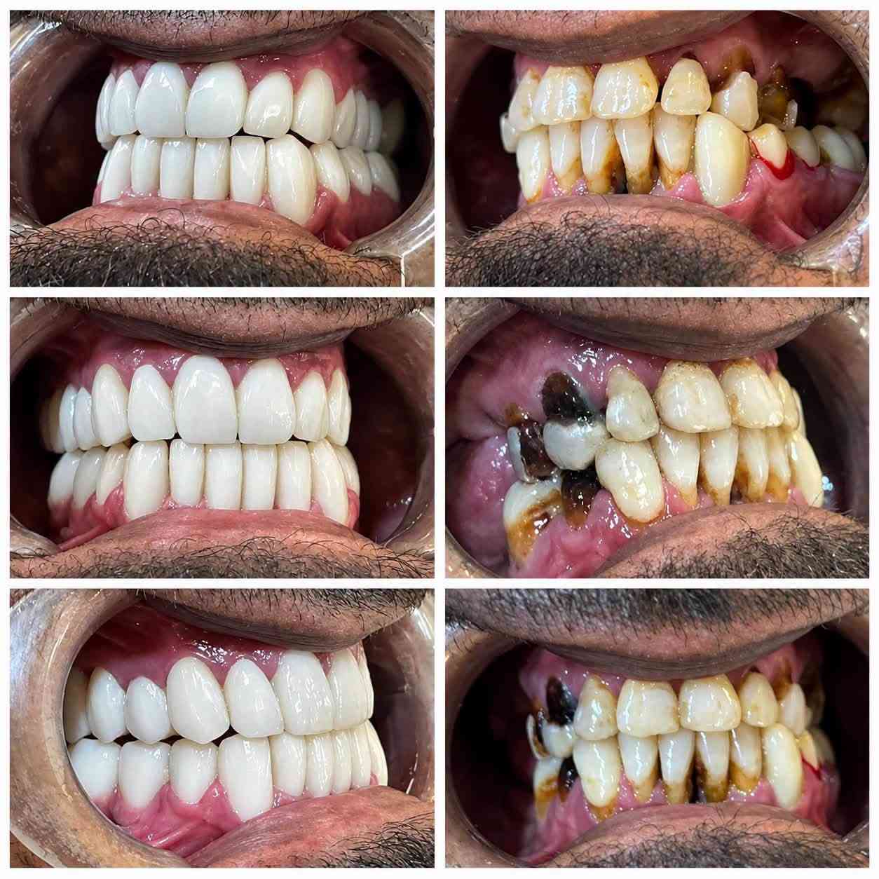😁✨ ابتسامتك يمنا غير!

خلّي ابتسامتك تحچي عنك 🤍
عناية متخصصة وابتسامة تليق بملامحك مع كادر قسم الأسنان 🦷✨

📍 الموقع: واسط – العزيزية – شارع الخليج – جانب البوابة
📞 للحجز والاستفسار: ***********

🏥 مستشفى روح الحياة الأهلي
🦷 قسم الأسنان
