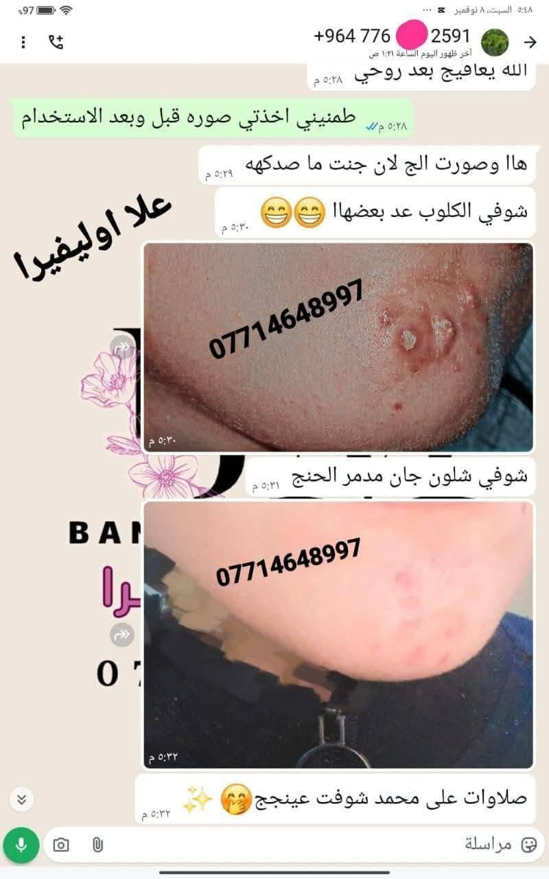 مع بكج العنبر المتكامل ماكو مستحيل 💪 منتجاتي الي اثبتت جدارته 🫶🏻ربي لك الحمد 🤲
عنوانه الثقه وتجاربنا تشهد  🫶 
انتبهو على تجارب كولهن بالارقام الهاتف  افتحو الصوره 
احبكم واحب تجاربكم

نص مكتوب في الصور:
- ***********
- علا اوليفيرا
- +964 773 8997
- معاد توجيهها
- بنان
- 07714
- OLA
- والله منتج يجن جاب نتيجه
- مراسلة
- علا اوليفيرا فرع ميسان
- *********** *********** علا اوليفيرا
- +964 782 280
- ۳ مرات بلسبوع تخلين فقط على بصله الشعر ولازم ينغسل ورا ما يبقى على شعر مده ٣ ساعات او ٤
- ١١:٣٥ م
- يصيرن 35 ١١:٣٦ م
- اكلج حبي وقبل سنه اختي اخدت منج زيت مدري شنو للشعر شنو للعسم مال الجسم
- ١١:٣٧ م
- وهسه ما عدهه شعر جسمهه صار خفيف كلش
- عندج منه
- 077
- OL
- ووجعي يدعيلج عل هل خلطه الحلوه والله اكعد من النوم منوره
- ١١:٣٩ م
- عود بعدني ما حافه
- علا اوليفيرا فرع ميسان ***********
- +964 776 2549 *********** هاي قبل تحضري للجمال *********** BAN يرا 077
- +964 776 2591 الله يعافيج بعد روحي ٥:٢٨ م طمنيني اخذتي صوره قبل وبعد الاستخدام ٥:٢٨ م هاا وصورت الج لان جنت ما صدكه ٥:٢٩ م علا اوليفيرا شوفي الكلوب عد بعضهاا ٥:٣٠ م *********** ٥:٣٠ م شوفي شلون جان مدمر الحنج ٥:٣١ م *********** ٥:٣٢ م صلاوات على محمد شوفت عينج ٥:٣٢ م مراسلة
- +964 786 7121 *********** علا اوليفيرا B A N كيمرر علا اوليفيرا والمسمن بديت بي قبل جم يومم خلاني شكد اكل اهلا وسهلا يقلبي ماشاءالله