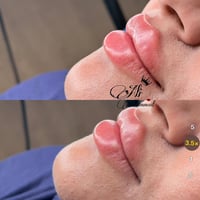 فلر شفة • العزيزية • مجمع طيبه