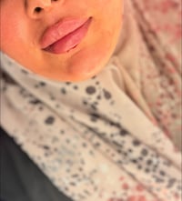 رسم شفه • الديوانية • تقسيط ماستر