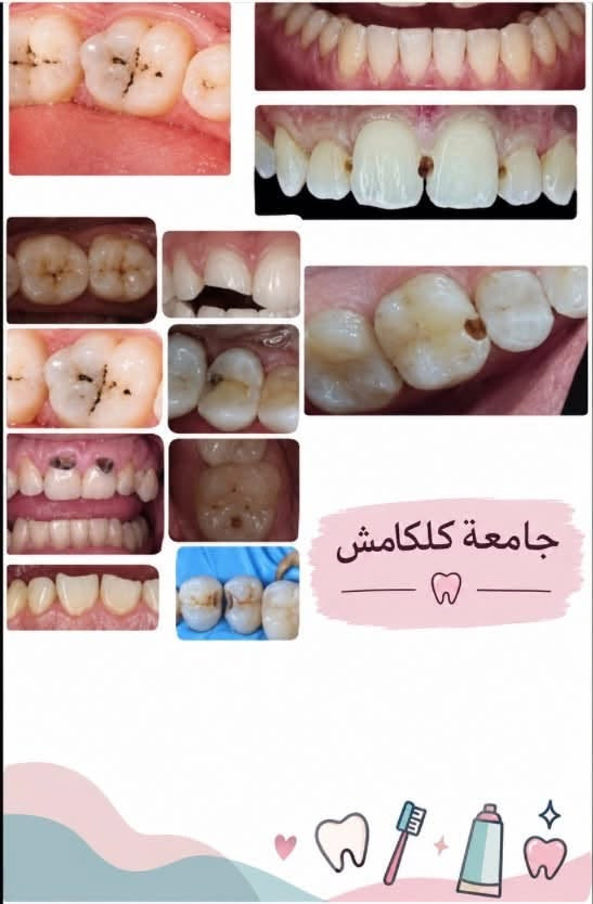 علاج مجاني • أطباء مختصين • جامعة كلكامش