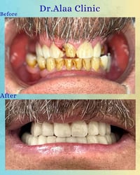 ابتسامة أجمل • تجميل أسنان • طبيب أسنان خبير