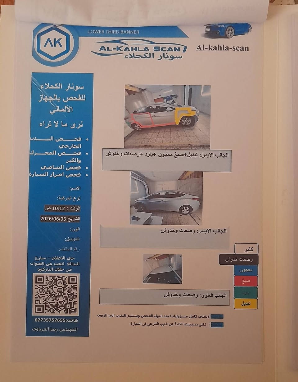 تحية طيبة.... النترا موديل ٢٠١٢ محرك جي دي اي ١٦٠٠ وارد كوري دشبول اسود ماشية ١٦٨ الف كيلو مو ميل بأسمي رقم سليمانية الجديد شرط التحويل نظامين قيادة عادي واقتصادي اشاير بالمري كاميرا خلفية وشاشة بيها جراد بالقمارة مكفول الدواخل من شاصي ولغود بيها مكانات صبغ ابيع حزام السونار موجود بالصور السعر  ٨٣ بيه مجال بسيط حك العملة 
المكان بغداد الكرخ للتواصل *********** موجود واتس اب

نص مكتوب في الصور:
- LOWER THIRD BANNER AL-KAHLA SCAN سونار الكحلاء Al-kahla-scan سونار الكحلاء للفحص بالجهاز الألماني نرى ما لا تراه فحص البدني الخارجي فحص المحرك والكير فحص الشاصي فحص أضرار السيارة المصد الخلفي : رصعات وخدوش المصد الامامي : بارد+رصعات وخدوش +صبغ كلير معجون صبغ بارد تبديل ملاحظة : نخلي كامل مسؤولياتنا بعد انتهاء الفحص وتسليم التقرير الى الزبون ملاحظة : نخلي مسؤوليتنا التامة عن العيب الشرعي في السيارة