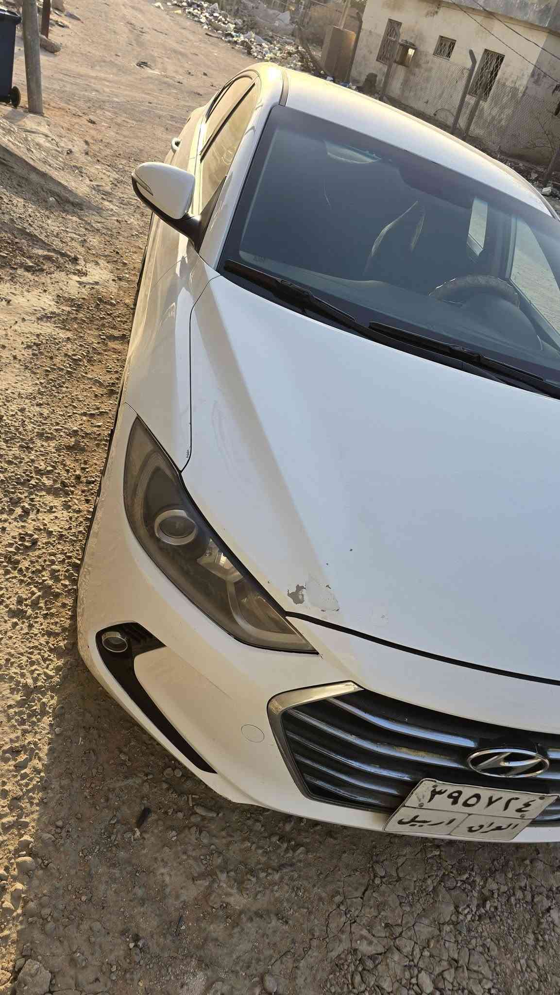 نتره ١٧ خليجي مكفوله من الصبغ والفتح مكينه الفين مكينه ما مفتوحه شركه السياره جاهزه خير من الله السعر ١٢٠استفسار اتصل ***********
***********
النتره ١٧ خليجي مكفوله من الصبغ والفتح مكينه الفين مكينه ما مفتوحه شركه السياره جاهزه خير من الله السعر ١٢٠استفسار اتصل ***********
