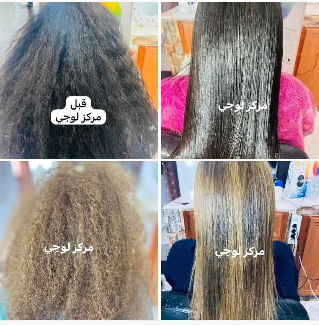 قبل مركز لوجي • تجميل • خاص