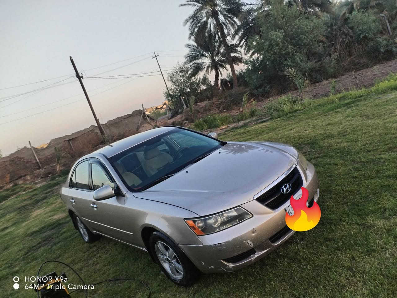 سوناتا ٢٠٠٧رقم بغداد
٢٤٠٠ب٩٠وبيهامجال
السيارة متواجدة بكركوك  أو سليمانية
***********

نص مكتوب في الصور:
- HONOR X9a
- 64MP Triple Camera
- HONOR X9a 64MP Triple Camera