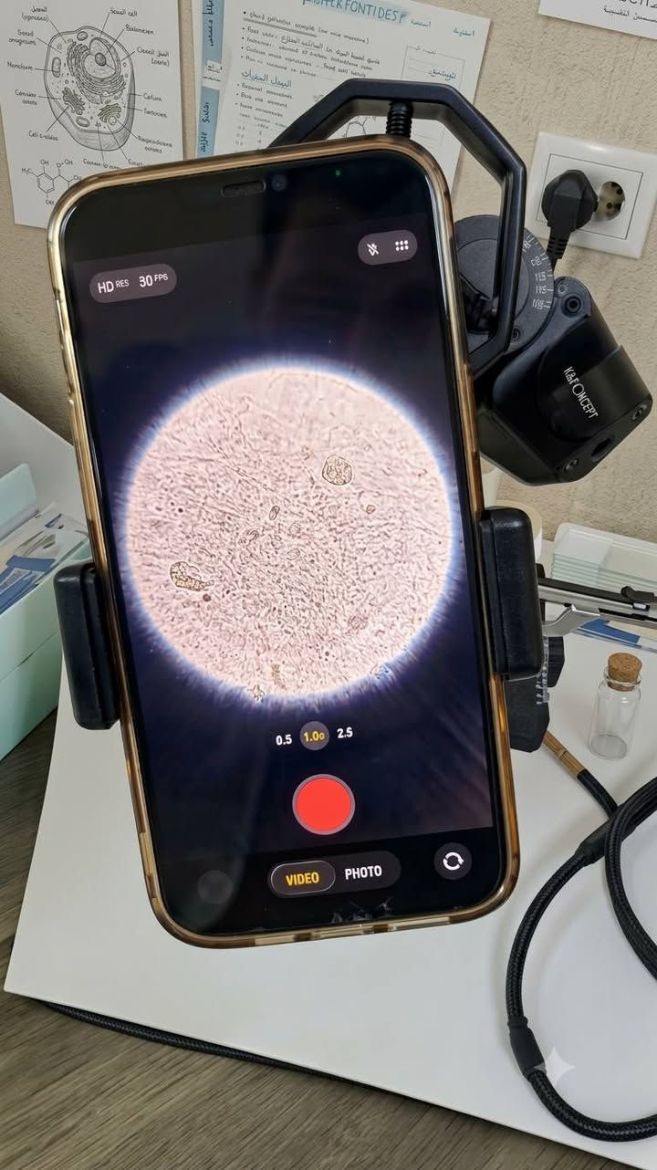 حصرياً في متجر أكاري لمستلزمات المختبريين! 🔬📱
وداعاً لإجهاد العين أثناء الفحص والعد، وأهلاً بالإنتاجية العالية والعمل الجماعي الممتع مع هولدر الهاتف الخاص بالمجهر.

لماذا تحتاج هذا الهولدر في مختبرك؟

توافق كامل: يشتغل على جميع أنواع المجاهر بدون استثناء.

مثالي للتدريب والتعليم: يتيح للجميع رؤية العينة والمساعدة في الحساب والعد في نفس الوقت.

راحة تامة للعين: يفحص ويعد بدقة عالية دون الحاجة لإجهاد عينيك على عدسة المجهر طوال اليوم.

دقة عالية في التشخيص: يساعدك بشكل ممتاز في فحوصات:

الإدرار العام (G.Urin.ex)

فحص الخروج (Stool)

معاينة وتشخيص حركة الحيوانات المنوية (Semen fluid)

ثبات واحترافية: يضمن لك تصوير الفحوصات بثبات عالٍ وتوثيق الحالات بسهولة.

🔥 عرض خاص ولفترة محدودة (لمدة أسبوع فقط) 🔥

السعر الحالي: 15,000 دينار فقط (السعر شامل التوصيل)

السعر السابق: 20,000 دينار

اشغل بثقة، صوّر بثبات، وريّح عيونك!

للطلب والاستفسار:
📞 تواصل معنا الآن عبر الرقم: ***********
