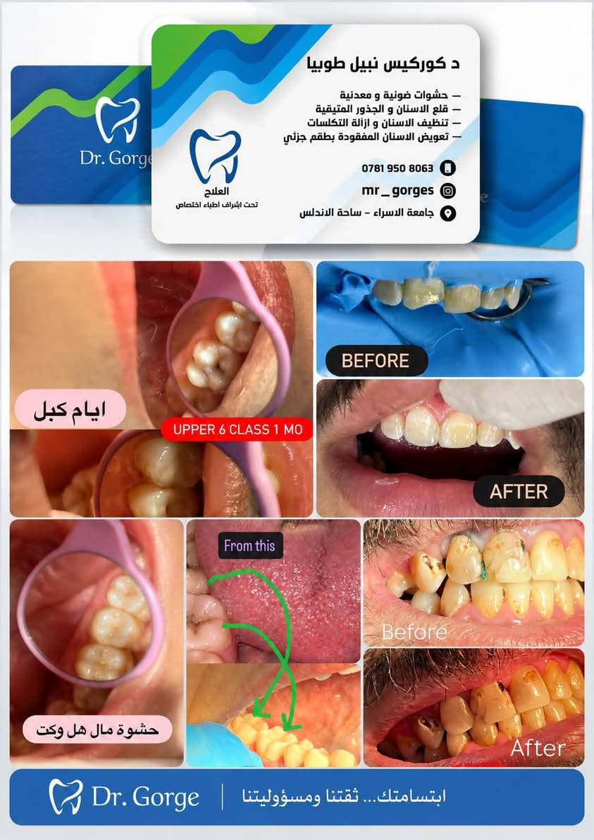 دكتور گورگيس • علاج اسنان مجاني • الكراده ساحة الاندلس