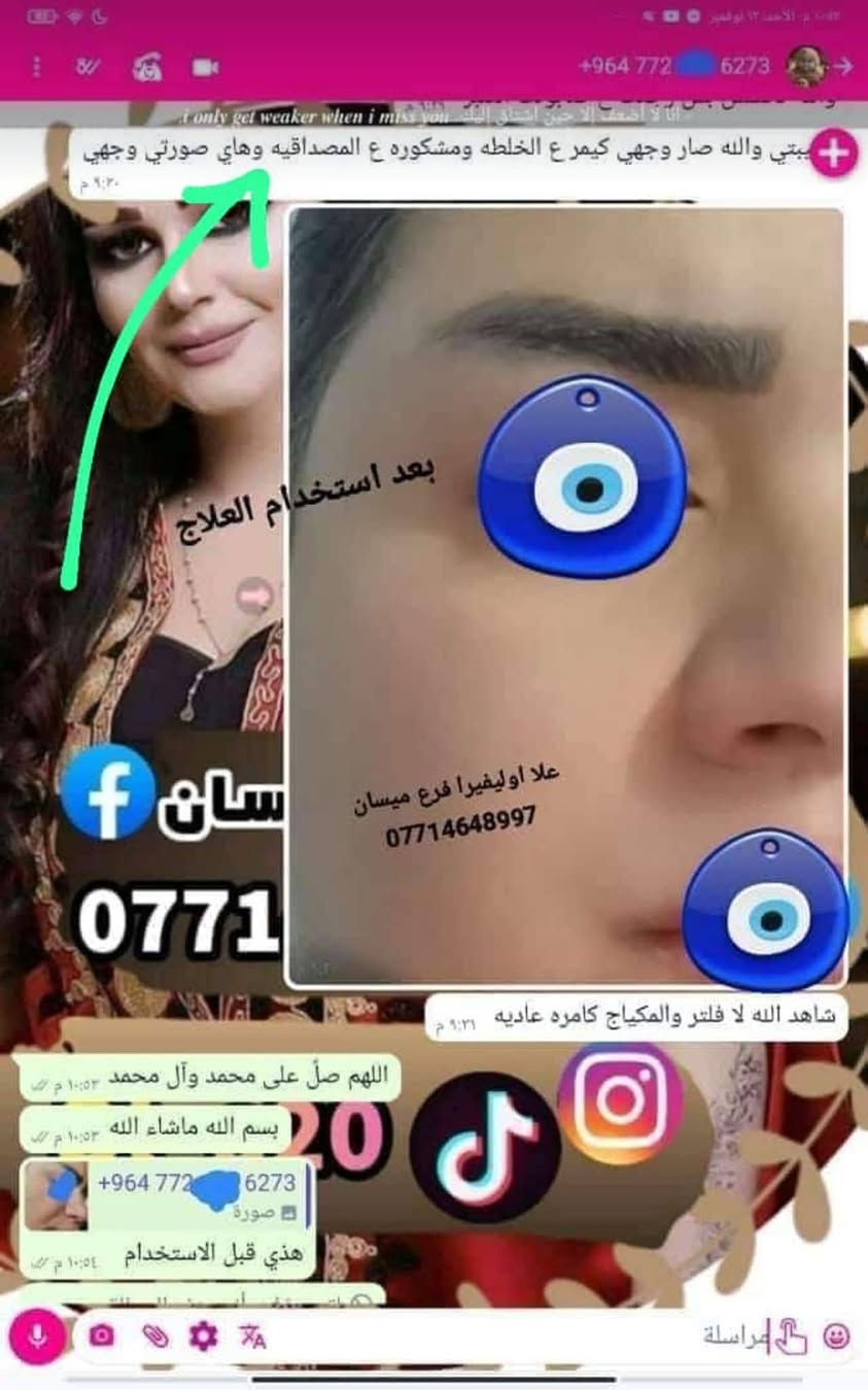 هايرونك • باكشويل • فرع ميسان