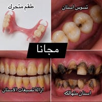 حشوات ضوئية • طقم متحرك • مستشفى جامعة البيان