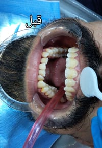 عيادة سوريسو • خدمات سنية • حي الحوراء