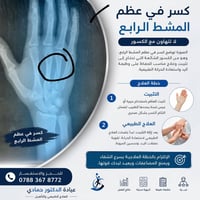 كسر المشط الرابع • جبيرة • علاج طبيعي