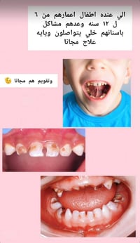 علاج مجاني • تقويم أطفال • جامعة ابن سينا