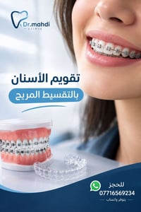 تقويم أسنان • تقسيط مريح • عيادة د.مهدي