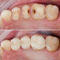 خدمات مجانية • طالب طب أسنان • عيادات القادسية