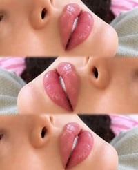 فيلر شفايف • تجميل • نزاكه