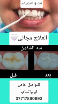مجانا • أطفال ٦-١٣ • فلورايد وسد الشقوق