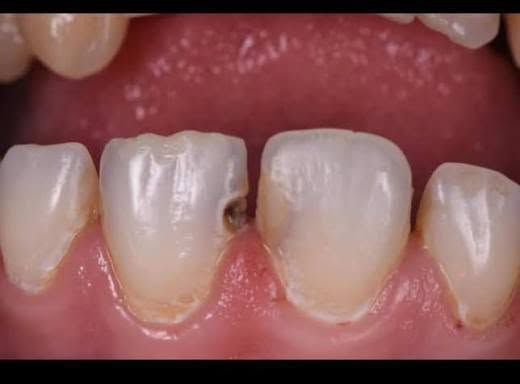 بسم الله الرحمن الرحيم
متواجدين ان شاء الله في عيادات كلية طب الأسنان - جامعة ذي قار مقابل مستشفى الحسين التعليمي بالخدمات:
الحشوات الضوئية 
قلع الاسنان المتهالكة وبقايا الجذور
تنظيف الاسنان
طقم جزئي متحرك
العمل بشكل مجاني (عدا رسوم الباص الرمزية)

للتواصل:
الحجز عبر الواتساب:
***********
الحجز عبر الانستقرام:
https://www.instagram.com/1zjik?stkn=anNmcWJicGMzMzZm
